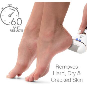 Rio Устройство для ухода за ногами PEDI4-EU/1.5, 60 сек, белый, 5ч, IPX5, USB зарядка, LED дисплей, 2 насадки (PEDI4-EU/1.5)