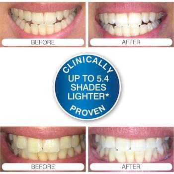 Rio Отбеливание зубов DCWU-EU/1,6, 15мин, 20 процедур, 1 насадка, 16 LED, Blue-Light Teeth Whitening™ (DCWU-EU/1,6)